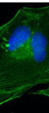 Contribution of p53-dependent and -independent mechanisms to upregulation of p21 in Fanconi anemia