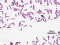 Gram stain