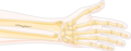 Forearm fracture - Radius fracture