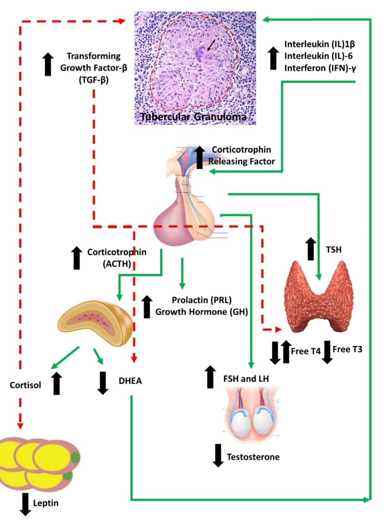 Figure 1. . Immune-Endocrine changes in male patients with tuberculosis (TB).