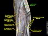 Anconeus muscle