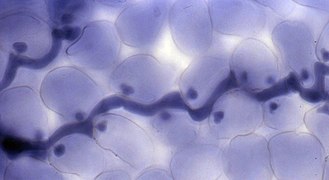 Seconde étape (végétative) du cycle court de H. parasitica : Formation d'hyphes par Hyaloperonospora parasitica (ici toujours dans une feuille d’Arabidopsis thaliana colorée au bleu de trypan marquant en bleu foncé le cytoplasme de H. parasitica). La longue structure est l'hyphe. Les petites sphères sont les haustoria.