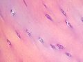 Chondrocytes in hyaline cartilage