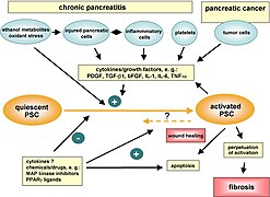 April 22: pancreatic stellate cell activation