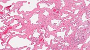 Thumbnail for File:Srifhistology3.jpg