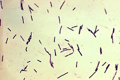 Clostridium perfringens