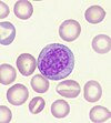 Neutrophylic_Myelocyte