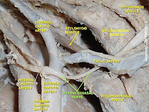 同拡大。緑色でHYPOGLOSSAL NERVEと書かれているのが舌下神経