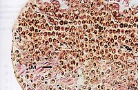 Cross section of the mantle tissue of a giant clam showing the symbiotic protozoa