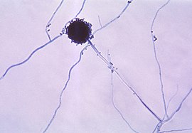 Aspergillus niger