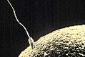 A sperm cell fusing with an ovum