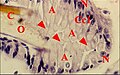 Fig.24 - Uroctea durandi , organe pharyngien, coupe oblique. A, adénocytes ; C, cuticule du pharynx ; Cc1, cellule canaliculaire proximale ; N, noyau adénocytaire ; O, orifices excréteurs ; Flèches : canalicules récepteurs et appareils terminaux.