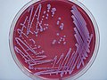 Colonies of B. pseudomallei on Ashdown's agar after 96 hours incubation at 37 degrees C.