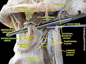 ヒトの首の部分。画像中央、ピンセットのすぐ上、緑色でHYPOGLOSSAL NERVEと書かれているのが舌下神経