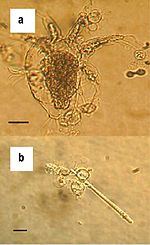 Thumbnail for Batrachochytrium dendrobatidis