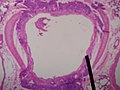 Cross-section of secondary bronchus