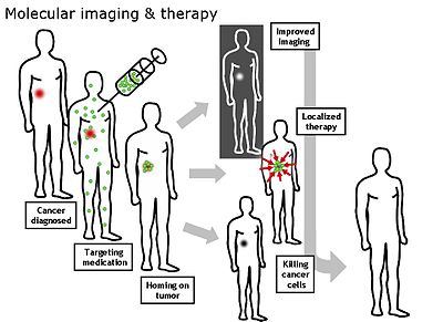 استفاده از تصویربرداری مولکولی تشخیص سرطان