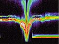 Over 1300 energy spectra taken on September 22, 2001 from the ion and electron instruments on NASA's Deep Space 1 span a region of 1,400,000 kilometers (870,000 miles) centered on the closest approach to the nucleus of comet Borrelly. A very strong interaction occurs between the solar wind (horizontal red bands to left and right in figure) and the comet's surrounding cloud of dust and gas, the coma. Near Deep Space 1's closest approach to the nucleus, the solar wind picked up charged water molecules from the coma (upper green band near the center), slowing the wind sharply and creating the V-shaped energy structure at the center. Deep Space 1 completed its primary mission testing ion propulsion and 11 other advanced, high-risk technologies in September 1999. NASA extended the mission, taking advantage of the ion propulsion and other systems to undertake this chancy but exciting, and ultimately successful, encounter with the comet. More information can be found on the Deep Space 1 home page at http://nmp.jpl.nasa.gov/ds1/ . Deep Space 1 was launched in October 1998 as part of NASA's New Millennium Program, which is managed by JPL for NASA's Office of Space Science, Washington, D.C. The California Institute of Technology manages JPL for NASA.