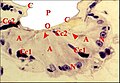 Fig.23 - Uroctea durandi, organe pharyngien de Millot, dit organe du goût, en fait glande segmentaire. Coupe frontale. A, adénocytes ; C, cuticule du pharynx ; Cc1, cellule canaliculaire proximale ; Cc2, cellule canaliculaire distale ; N, noyau adénocytaire ; O, orifices excréteurs ; P, cavité du pharynx. Flèches : canalicules récepteurs et appareils terminaux.