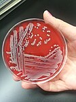 Staphylococcus aureus: large opaque, round, creamy, white to yellowish colonies displaying beta-hemolysis on blood agar[1]: 167–73 