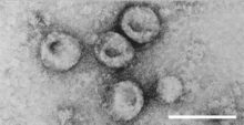 virions of "Pestivirus" sp.