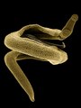 Mnyoo-kichocho (Schistosoma mansoni)