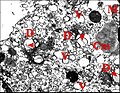 Fig.16 - Leptyphantes sanctivincentii - Organites d'un adénocyte, autre vue. Cm, corps myéloïde ; D, appareil de Golgi (dictyosome) ; Ex, cavité extracellulaire ; Mt, mitochondrie ; N, noyau ; P, plasmalemmes accolés ; V, vésicules. Flèches rouges : matériel lamellaire dans le Golgi