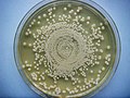 Colonies of B. pseudomallei on Müller-Hinton agar (used in the US for sensitivity testing)