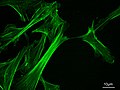 Filaments d'actine dans des fibroblastes embryonnaires de souris, colorés à la phalloïdine.