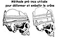 Méthode pré-Inca des planchettes