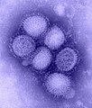 H1N1 influenza