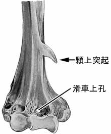 上腕骨