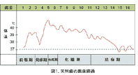 天然痘