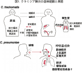 クラミジア肺炎