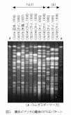 腸炎ビブリオ感染症